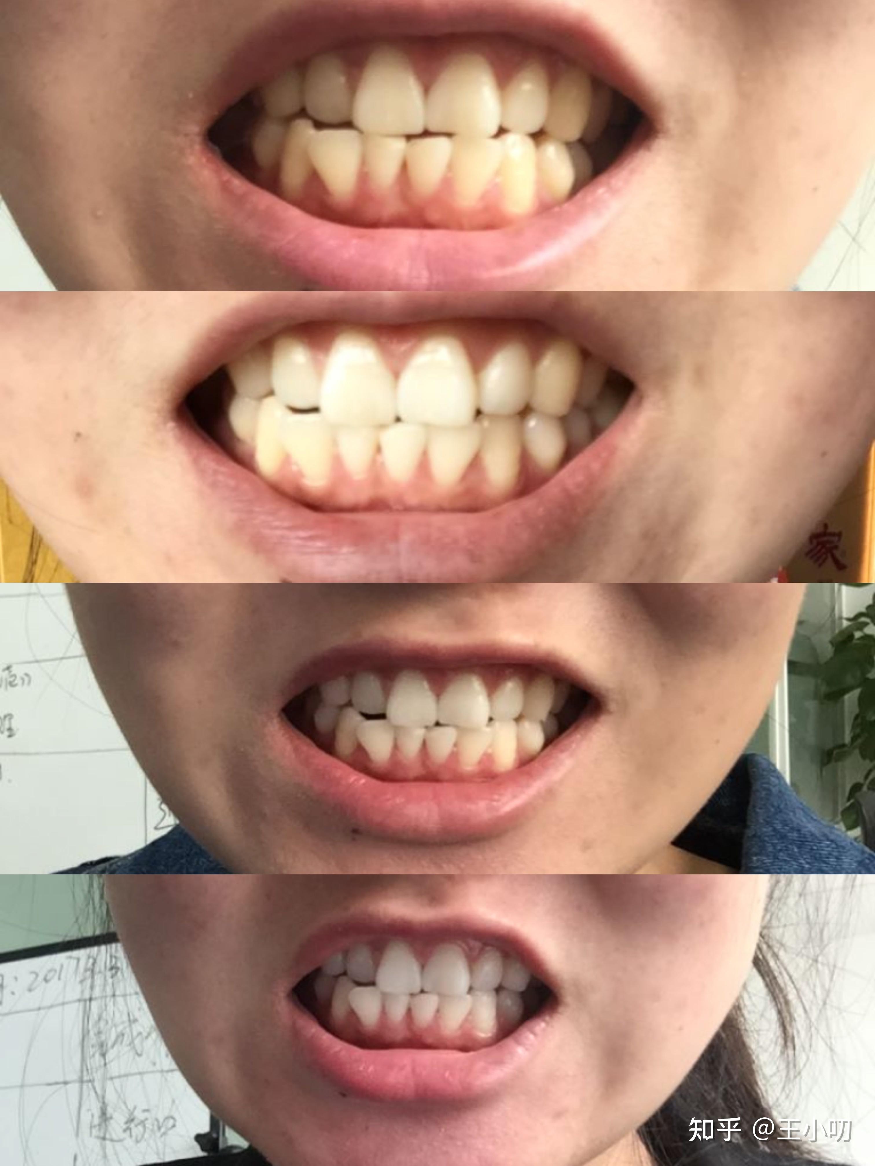 3024_4030竖版 竖屏