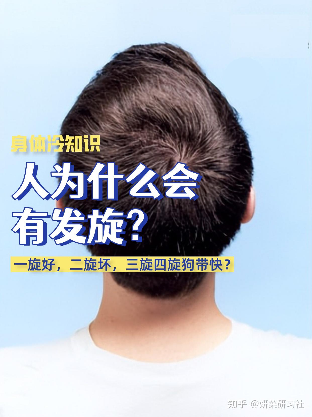 发旋是怎么来的？你有几个旋儿？ - 知乎