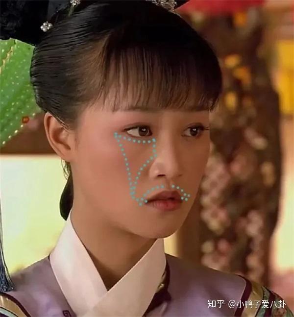 弹性纤维断裂,肌肤就会干瘪,向下耷拉,嘴角从平到下垂,法令纹越来越