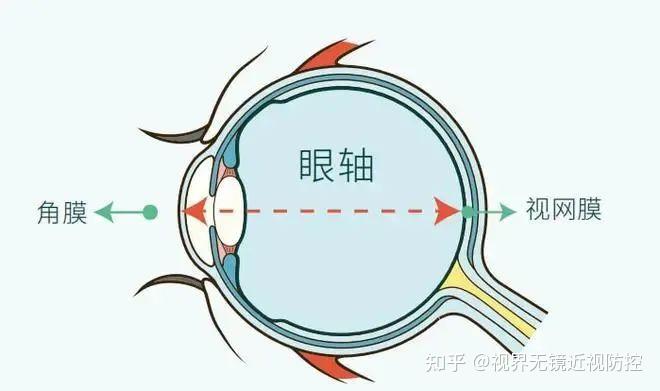 爱眼科普 | 眼轴短就不会近视？小心弱视！ - 知乎