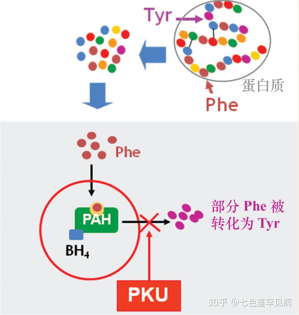 干货 | 苯丙酮尿症(PKU)致病机理 - 知乎