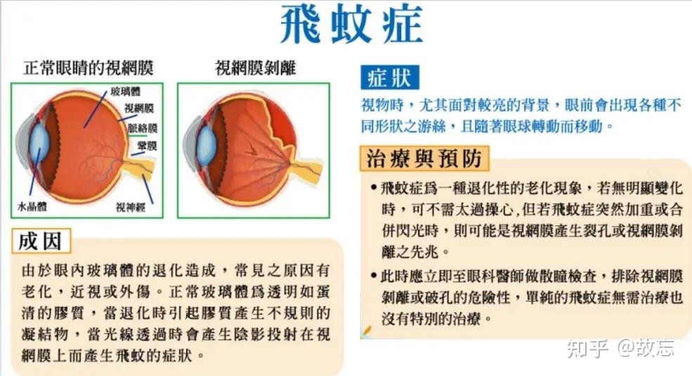 引起飞蚊症的常见因素和预防手段