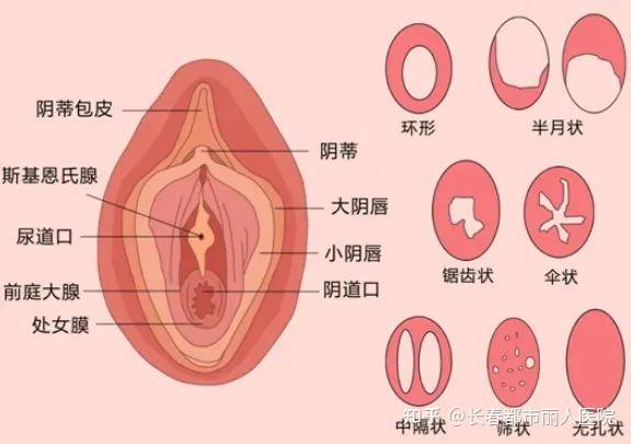 处女膜，现在还重要吗？