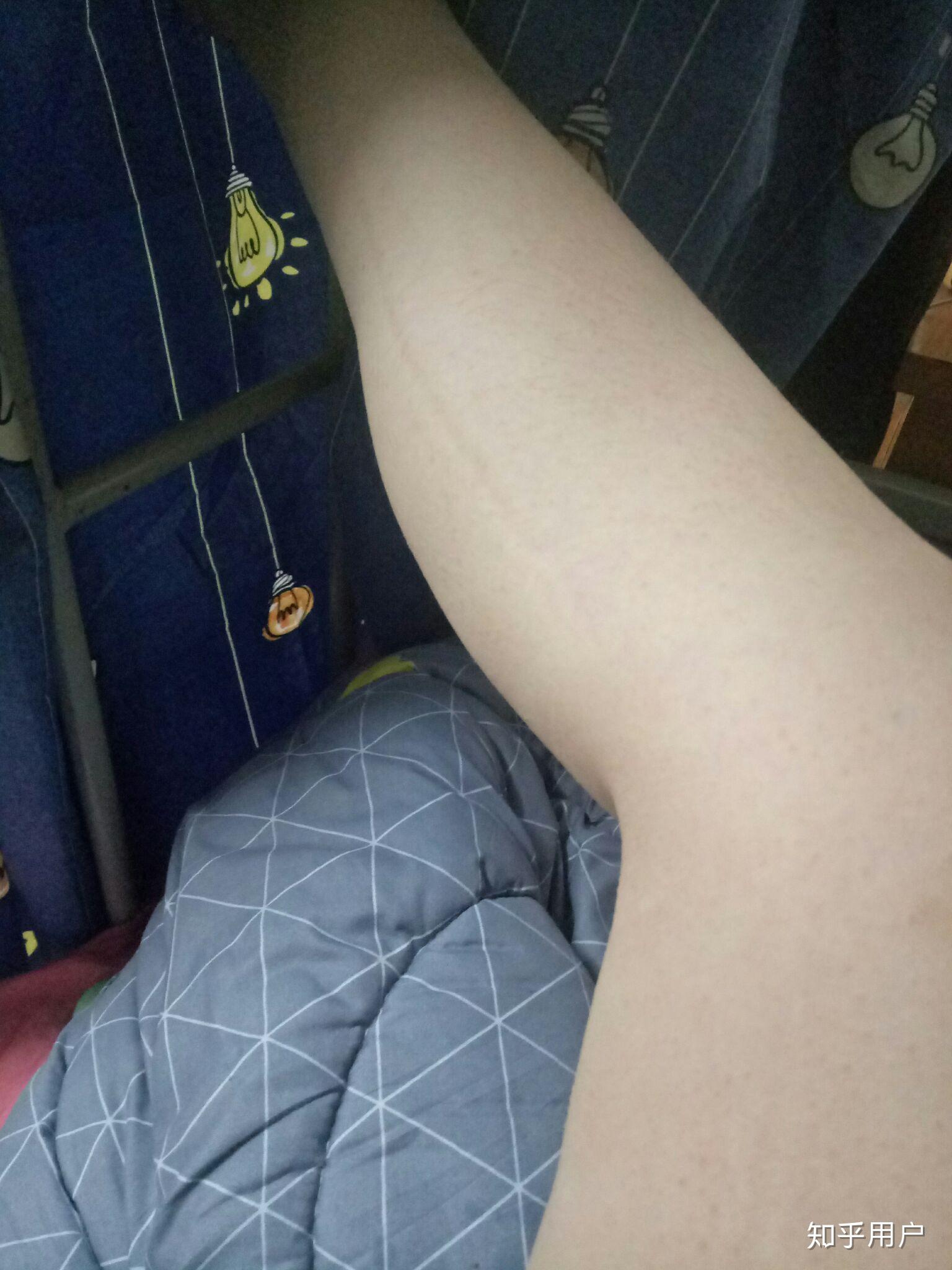 女生肌肉型小腿是什么体验