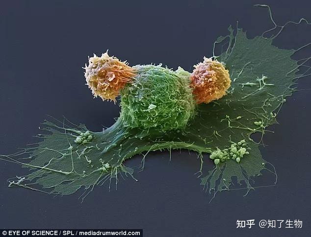 不常见的细胞吞噬图片,像极了传世油画