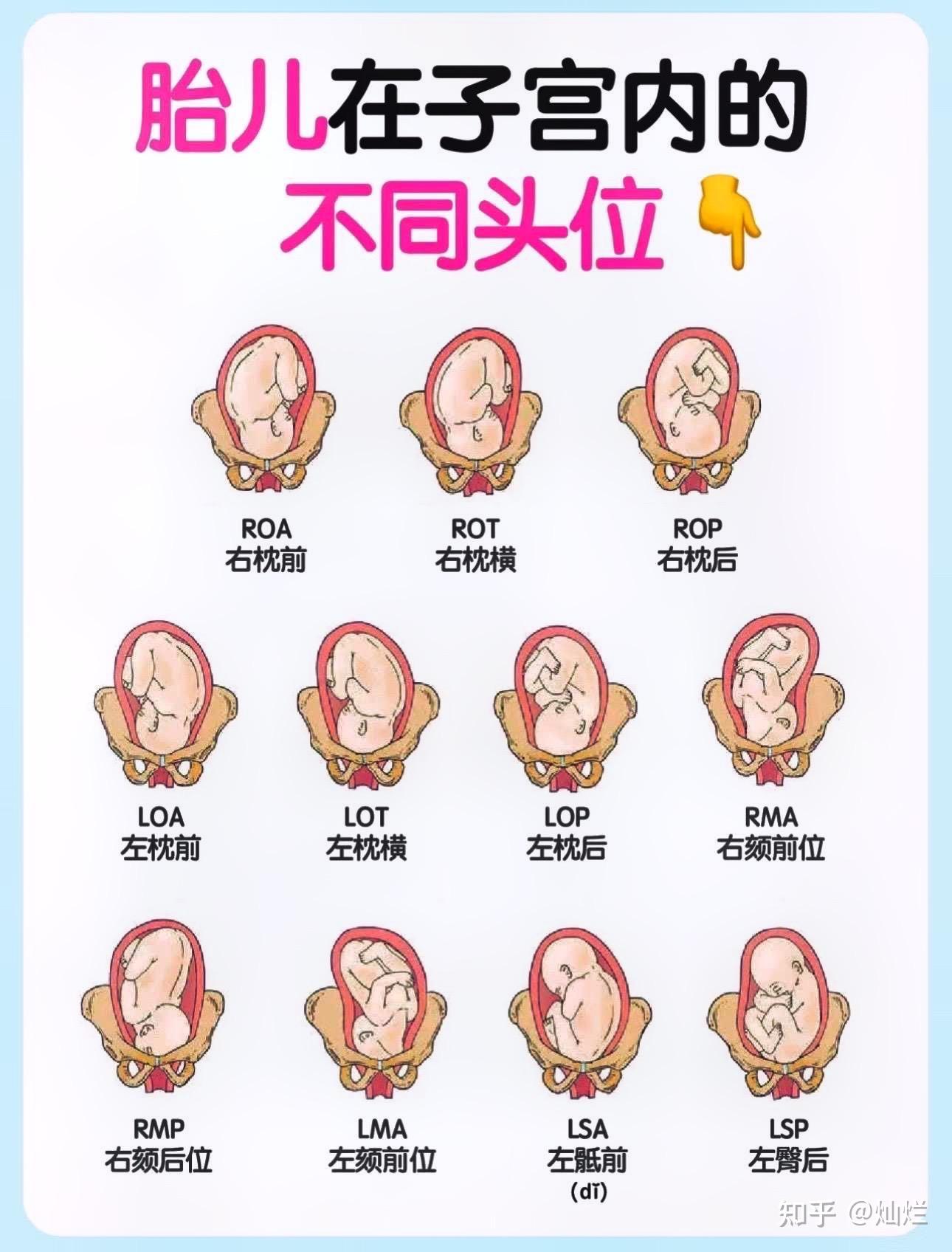 产时超声系列(文献翻译1)——ISUOG 实践指南:产时超声检查(2018年7月发表) - 知乎
