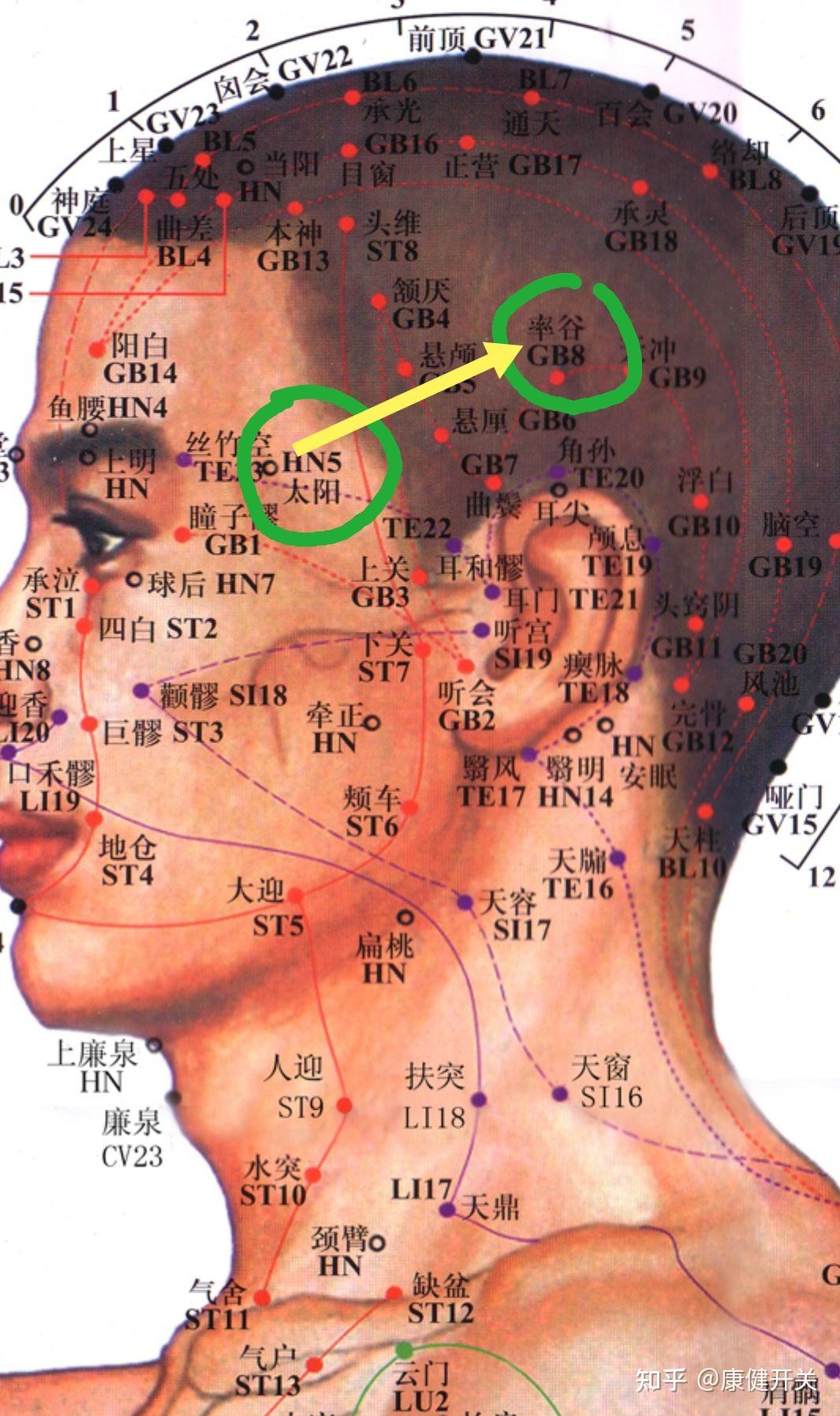 头部痛点的准确位置图图片