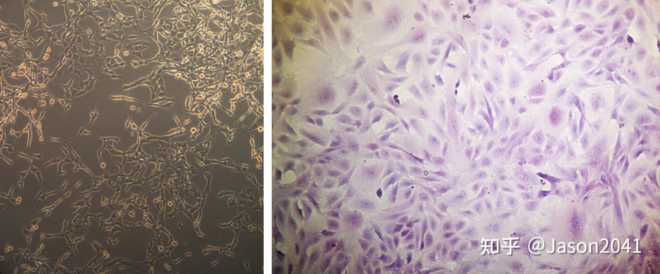 成纤维细胞的形态