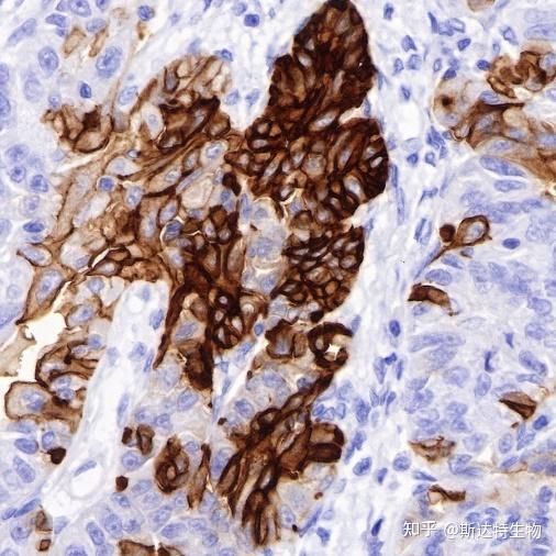 新兴靶点B7-H3/H4，助力ADC药物研发 - 知乎