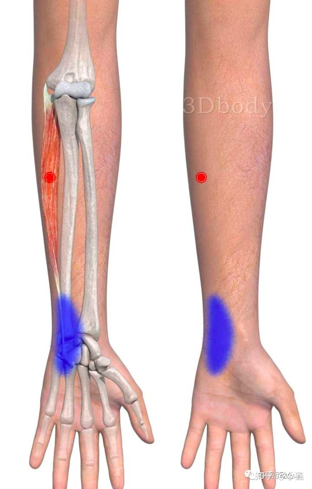 尺侧腕屈肌位置图图片