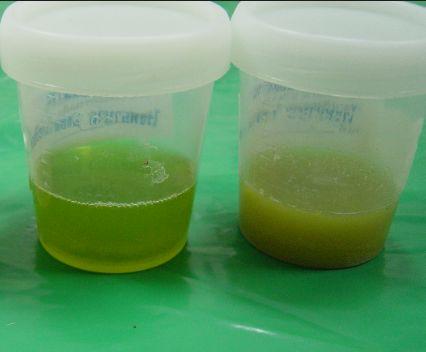 这是因为我们吃进肚子的食物,除了唾液,胃酸等消化液外,还需要胆汁的