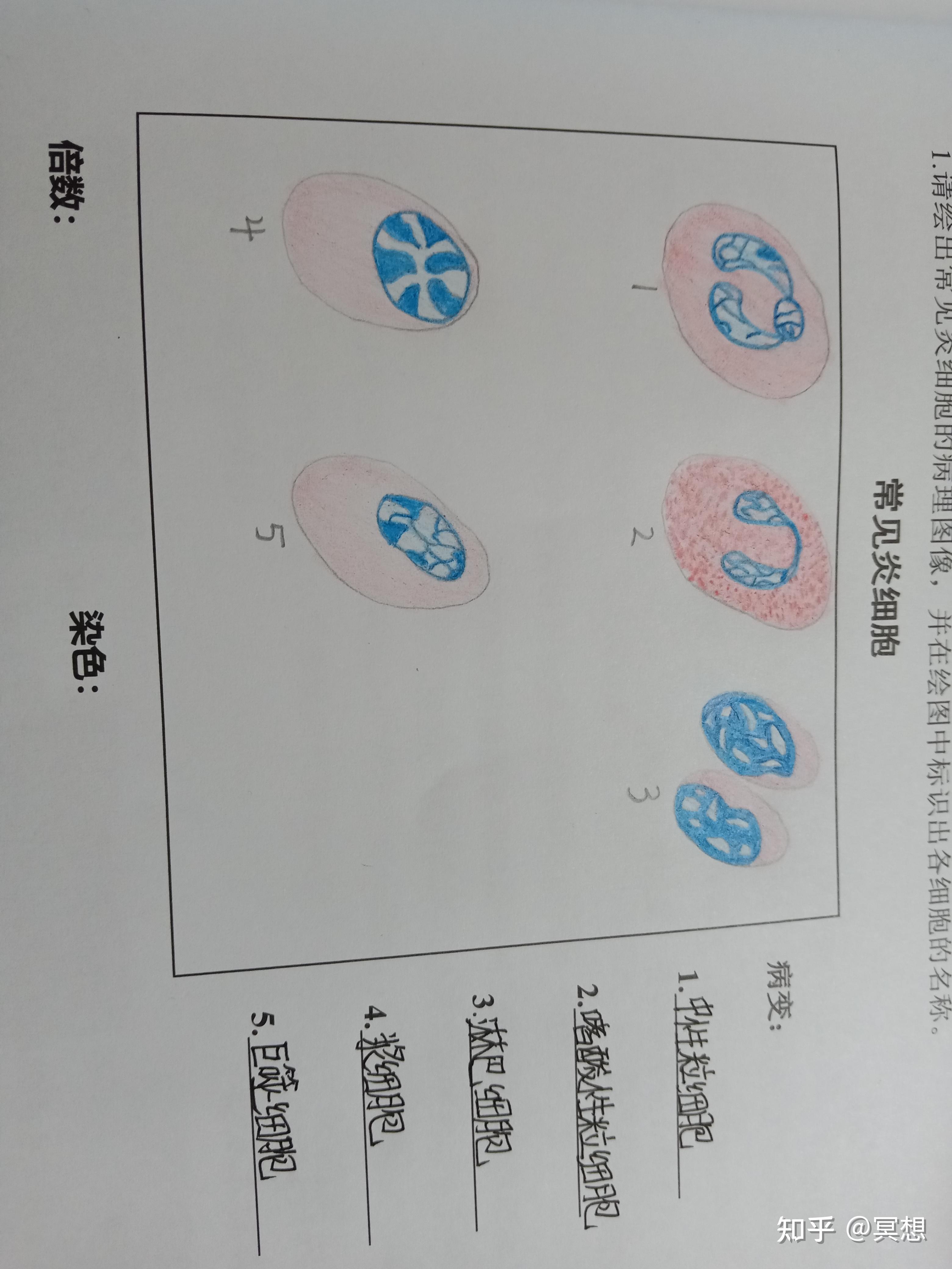 病理学绘图:常见炎细胞 