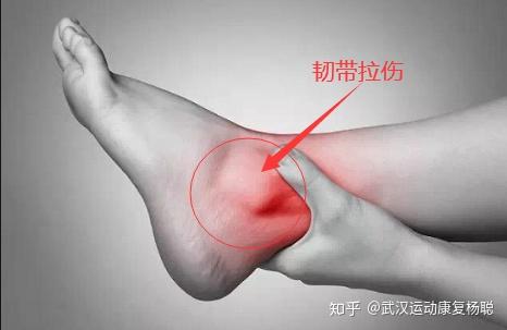 脚踝有哪些常见的损伤你的踝关节疼痛代表什么损伤