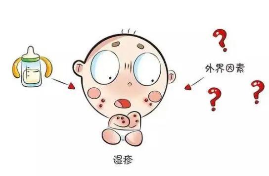 婴儿湿疹反反复复怎么根除告诉宝妈们一个好方法