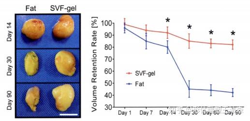 解析：脂芯SVF-gel脂肪胶是什么？它长什么样子？ - 知乎