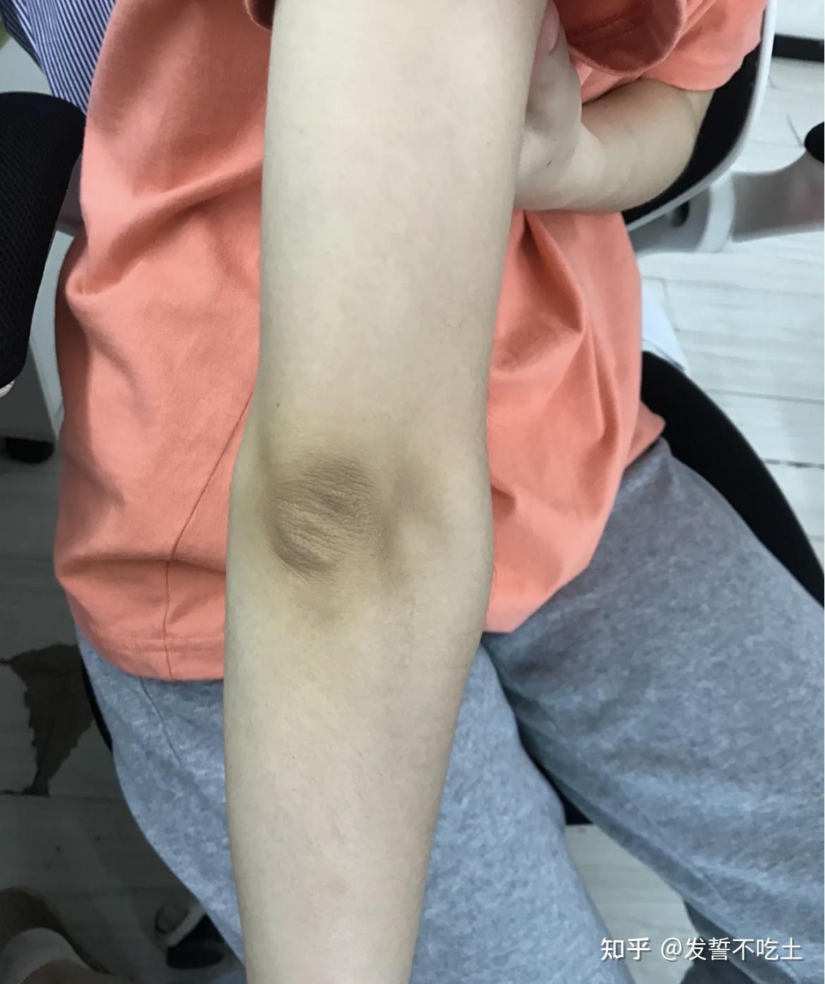 大学生有什么靠谱不留黑点的脱毛膏推荐