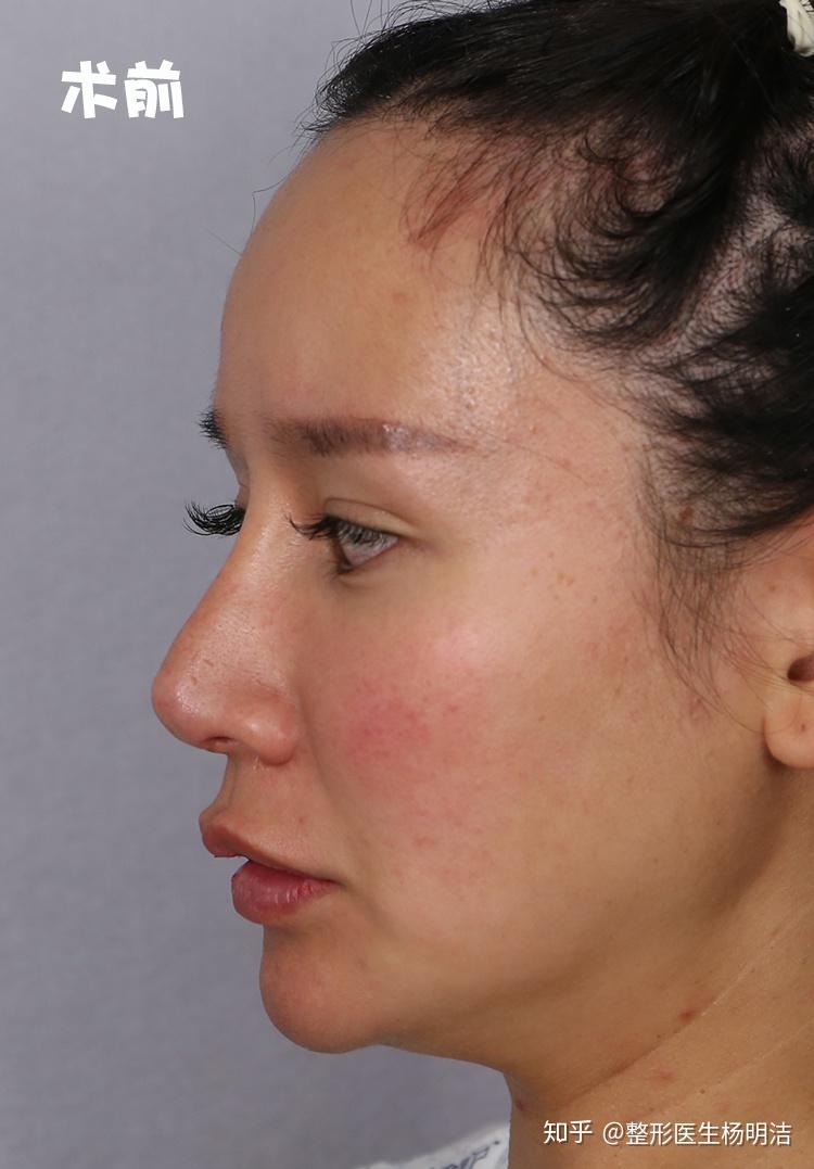 整形背后的故事