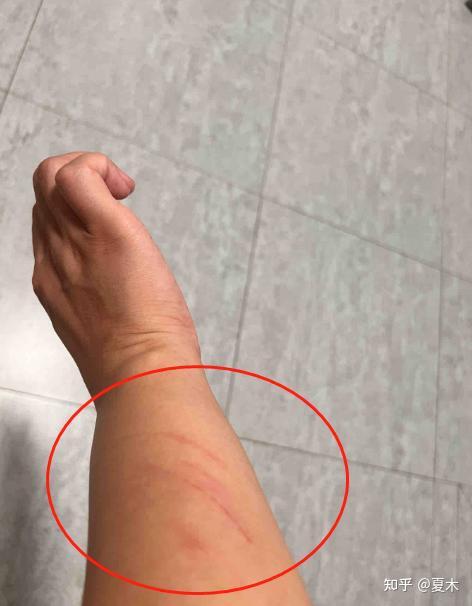被窗户角磕破头!预防二次伤害,请使用窗户防撞角! - 知乎