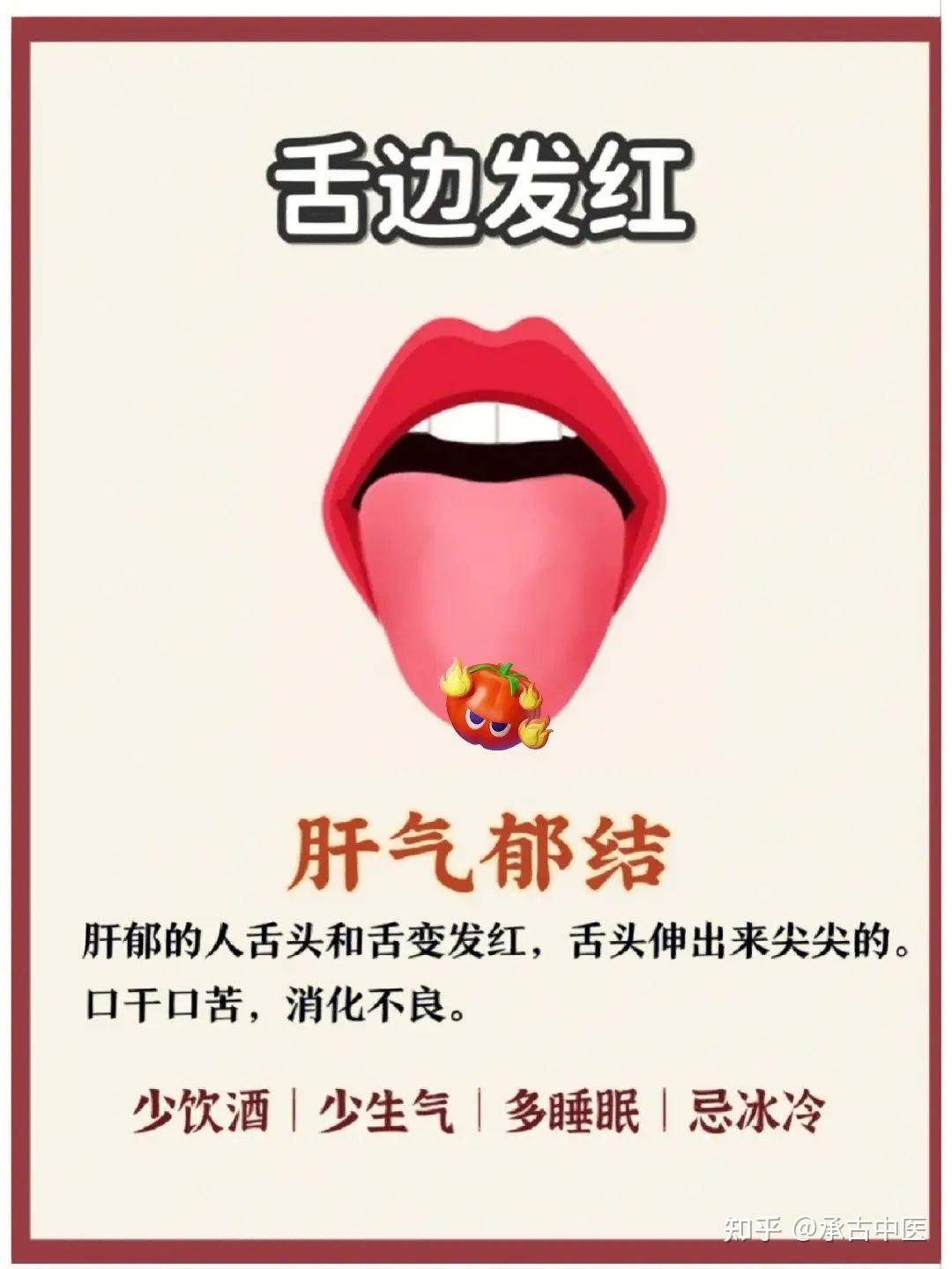 舌诊的原理 - 知乎