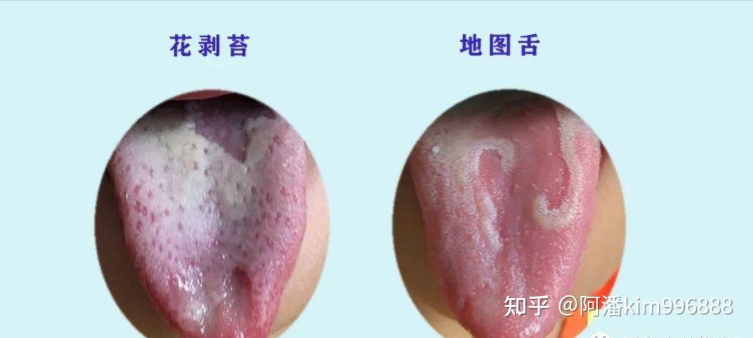 转 舌像辨症状 - 知乎