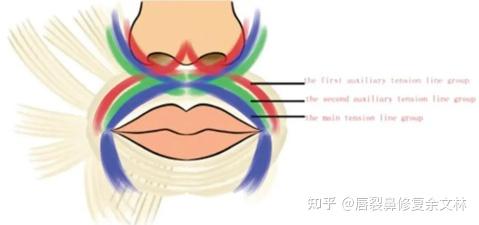 为什么那么多唇裂都是塌鼻子? - 知乎