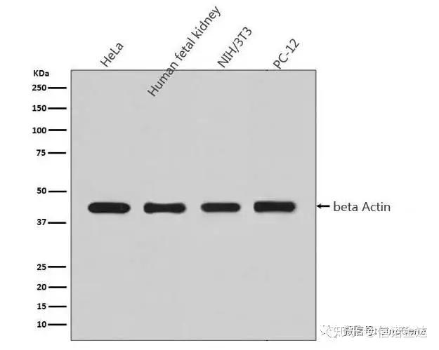 Western Blot 中如何选择内参抗体? - 知乎