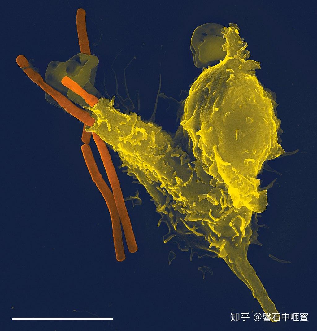 免疫系统immunesystem