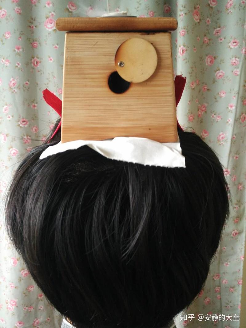 头痛的要命艾灸百会让我活了