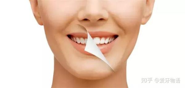 洗牙能让牙变白吗