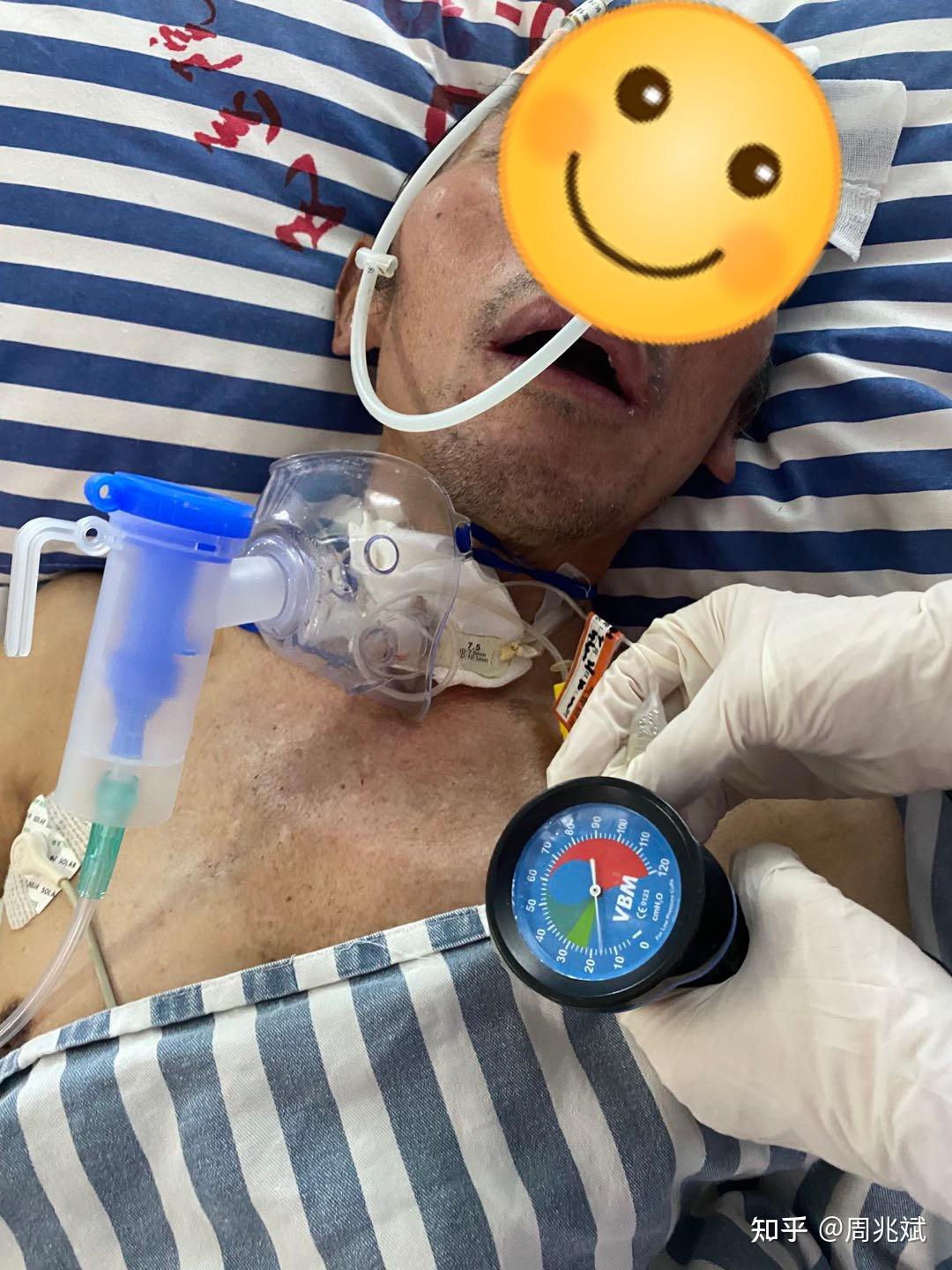 说话瓣膜语音阀对气管切开患者生理与临床预后有哪些影响