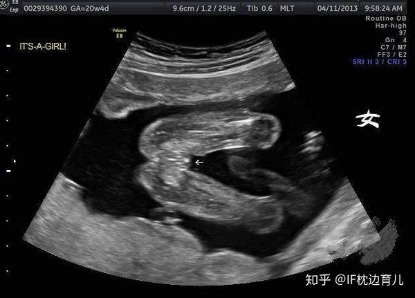 怀孕4个月是什么感觉呢 孕妈和胎儿各不同 注意事项也很多 知乎