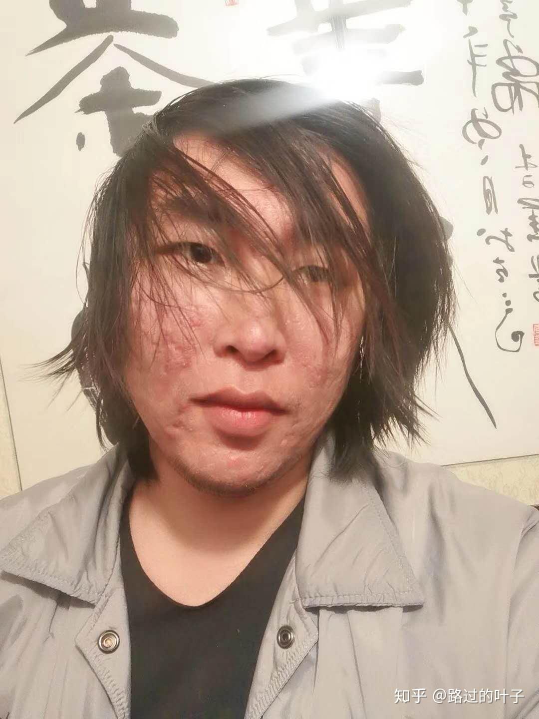 男生长得丑还留长发是什么体验