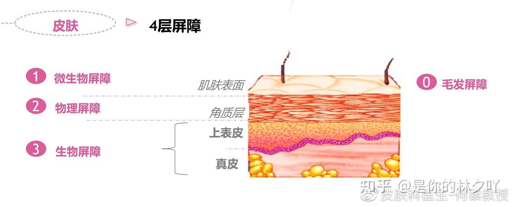 皮肤屏障是什么？你都了解吗？ - 知乎