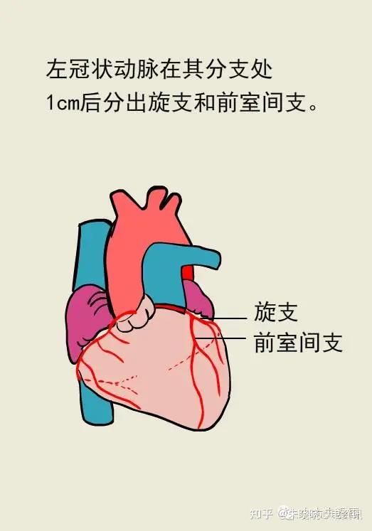 图解冠脉造影