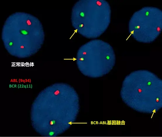 癌症检测系列之FISH – 点亮暗场中的致病基因 - 知乎