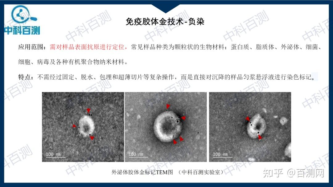 免疫电镜技术介绍,绝对干货! - 知乎