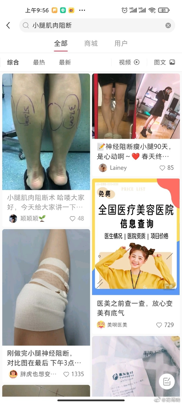 缠足深度调查 隐秘角落中的封建毒瘤 正在残害无数年轻人 知乎