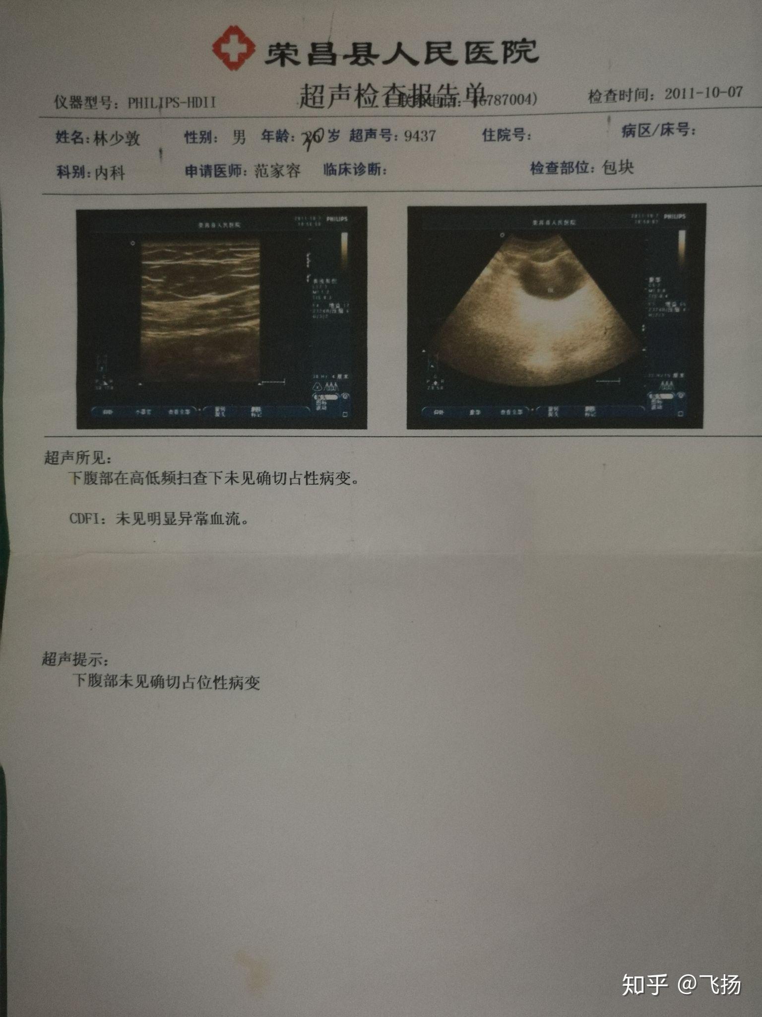 腹膜后纤维瘤康复十二年,给大家带来喜讯