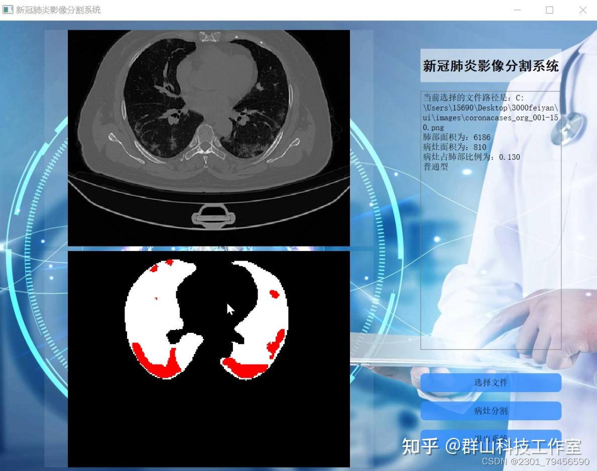 改进unet的新冠肺炎ct影像病灶分割系统（部署教程和源码） 知乎 9545