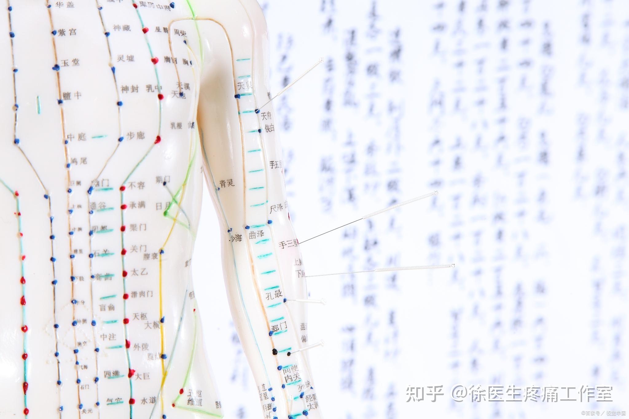 7种常见下背痛位置与原因，教你如何鉴别诊断！ - 知乎