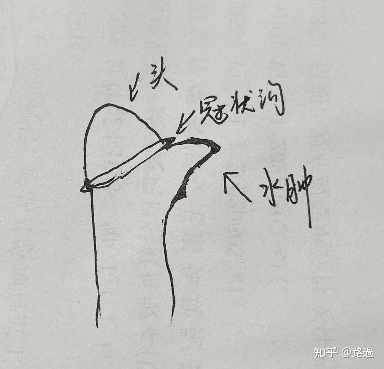 了,bq没什么影响,就是疲软的时候老是感觉还有点肿的样子,吃了迈之灵