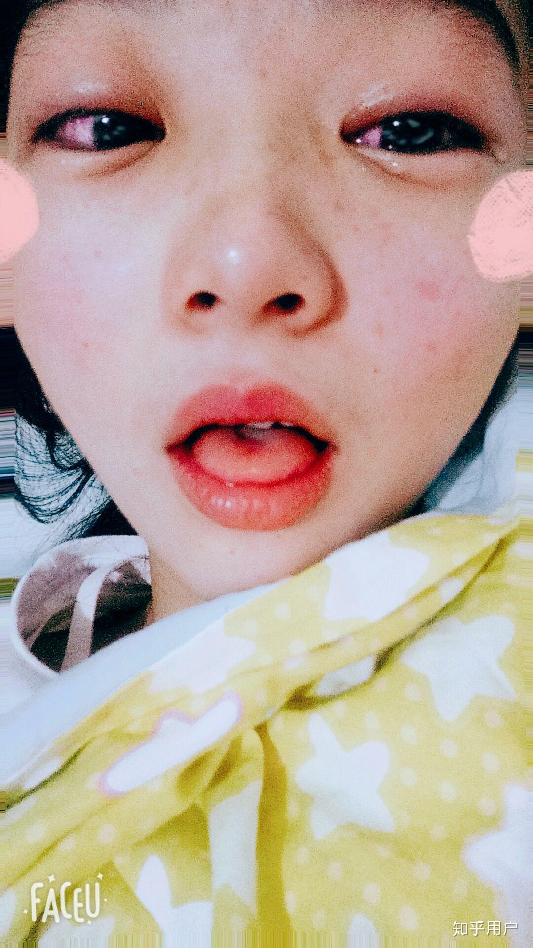 眼睛哭肿是怎样一种体验