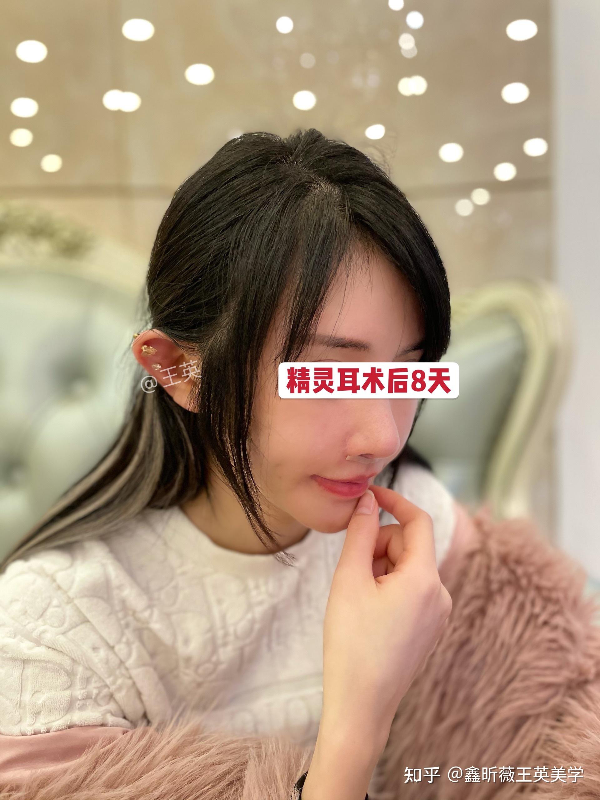 我去做了精灵耳,发现我的头真的变小了～ - 知乎