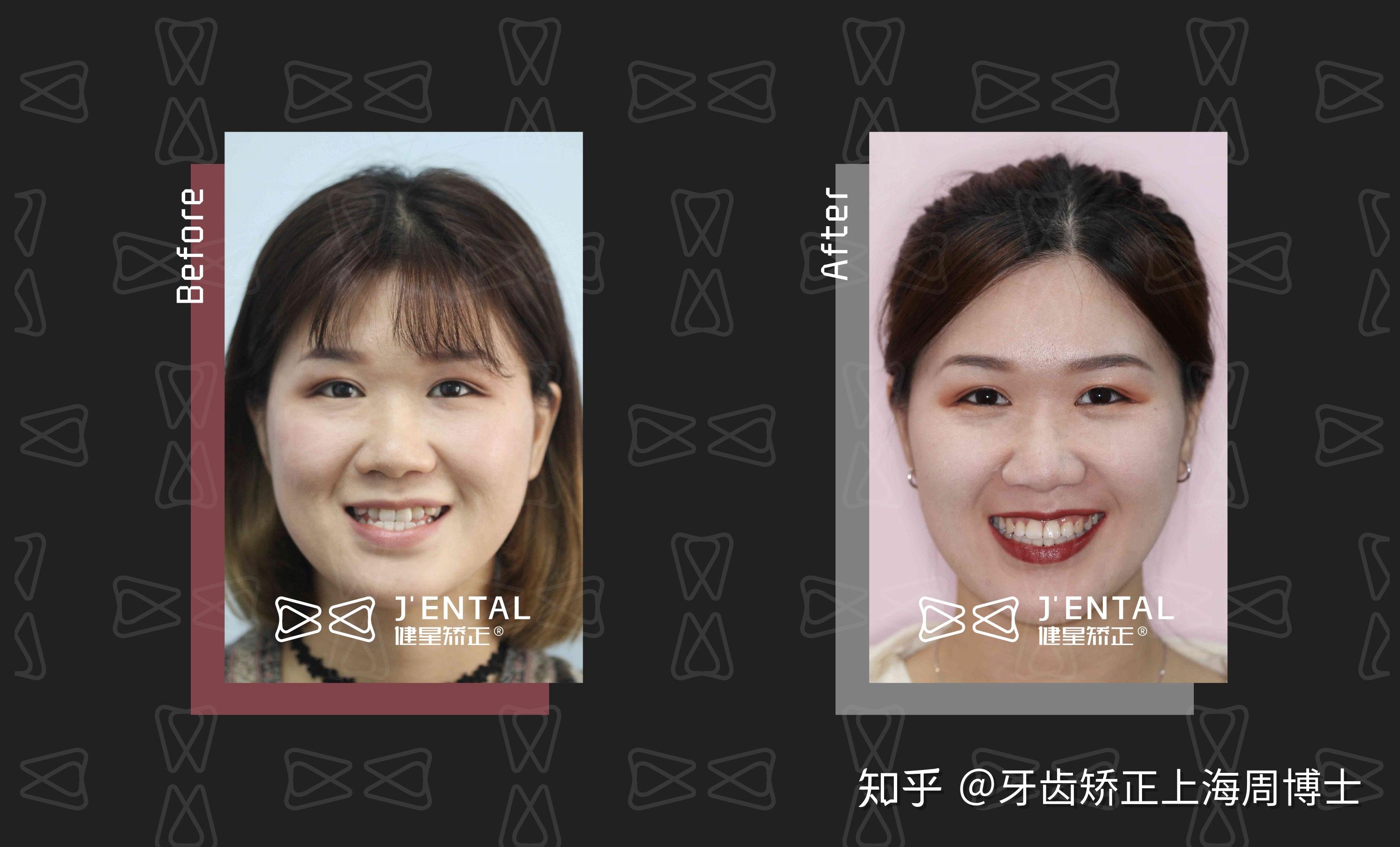 可怕的微笑曲线 v2-9d9ffb725192a4fa0619f0202e3d7182_r.jpg