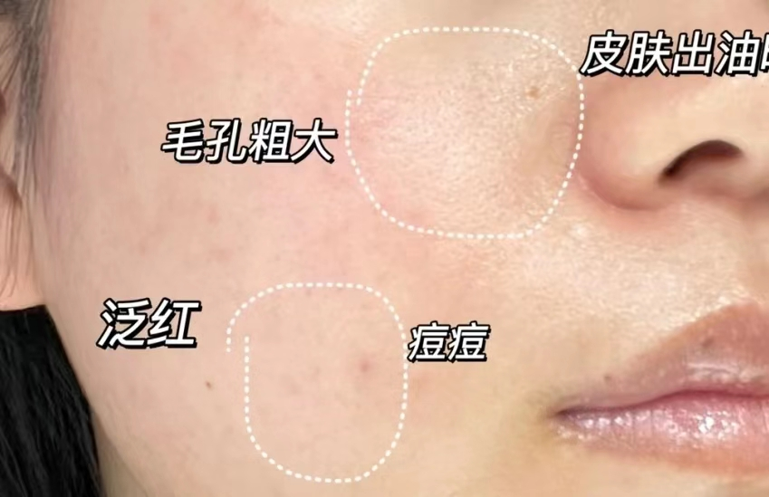 大油皮是一种怎样的体验?