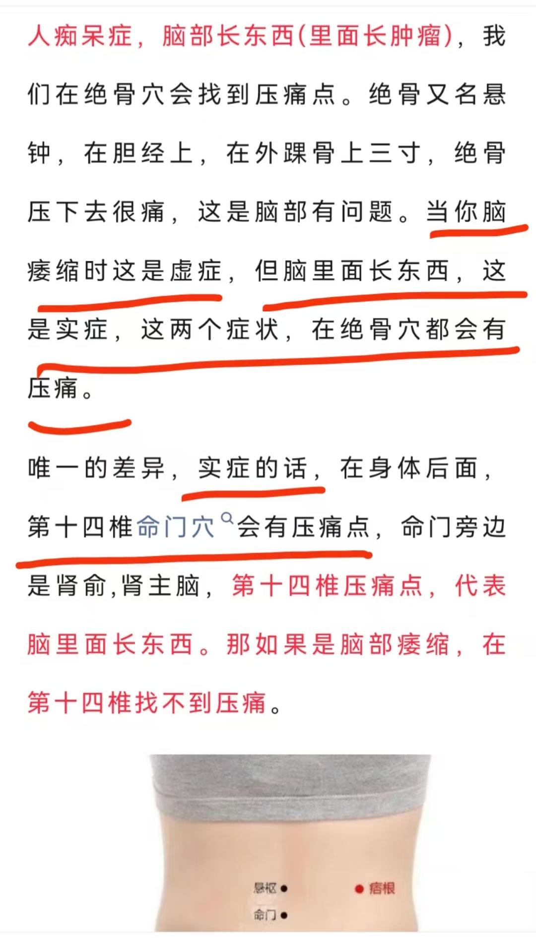 绝骨穴悬钟穴的应用笔记 - 知乎