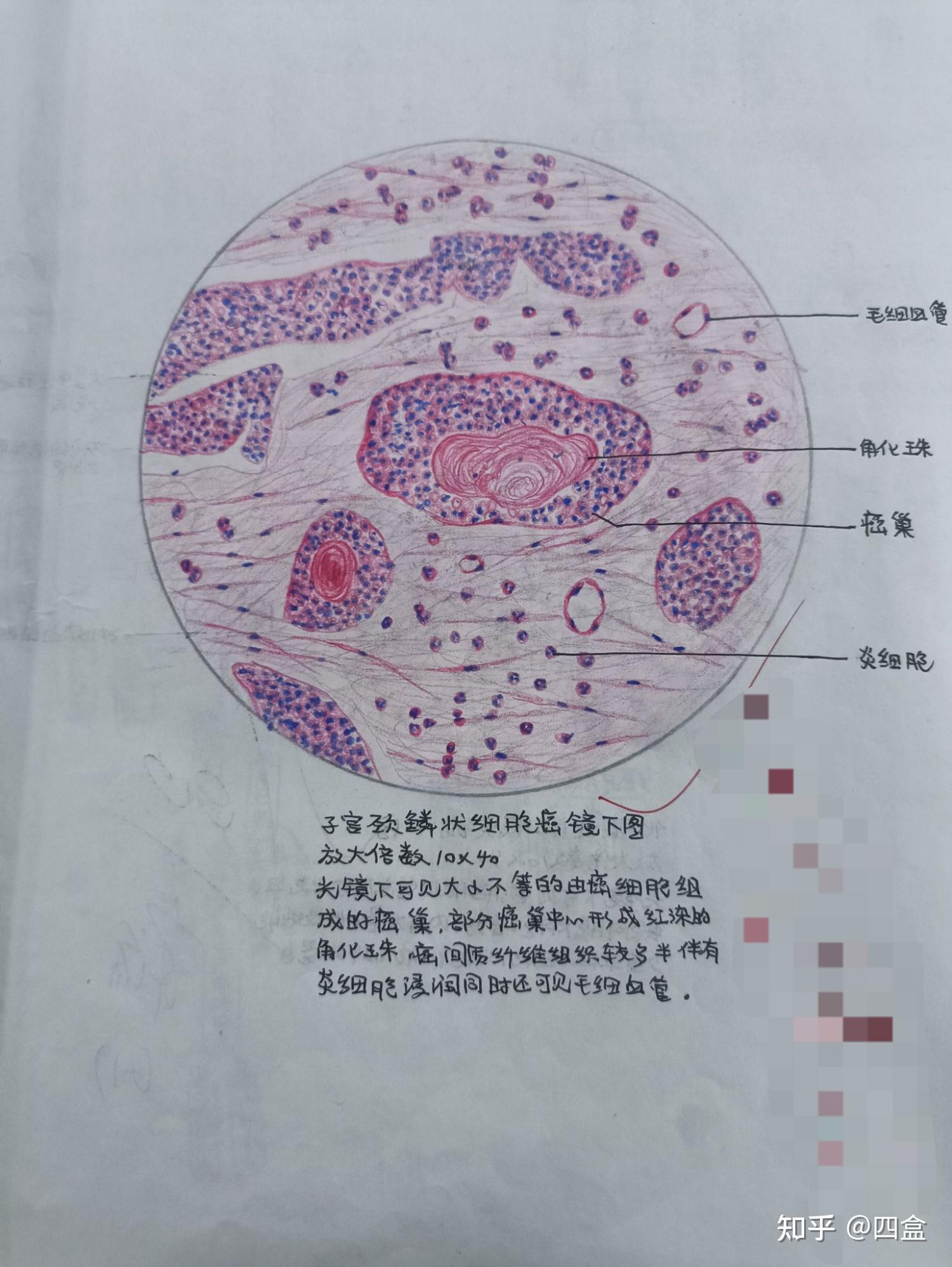 血细胞手绘图红蓝铅笔图片