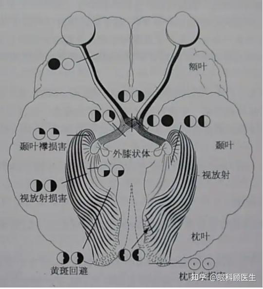 光感受器是視網膜上的第一級神經元,分視杆細胞和視錐細胞兩種.