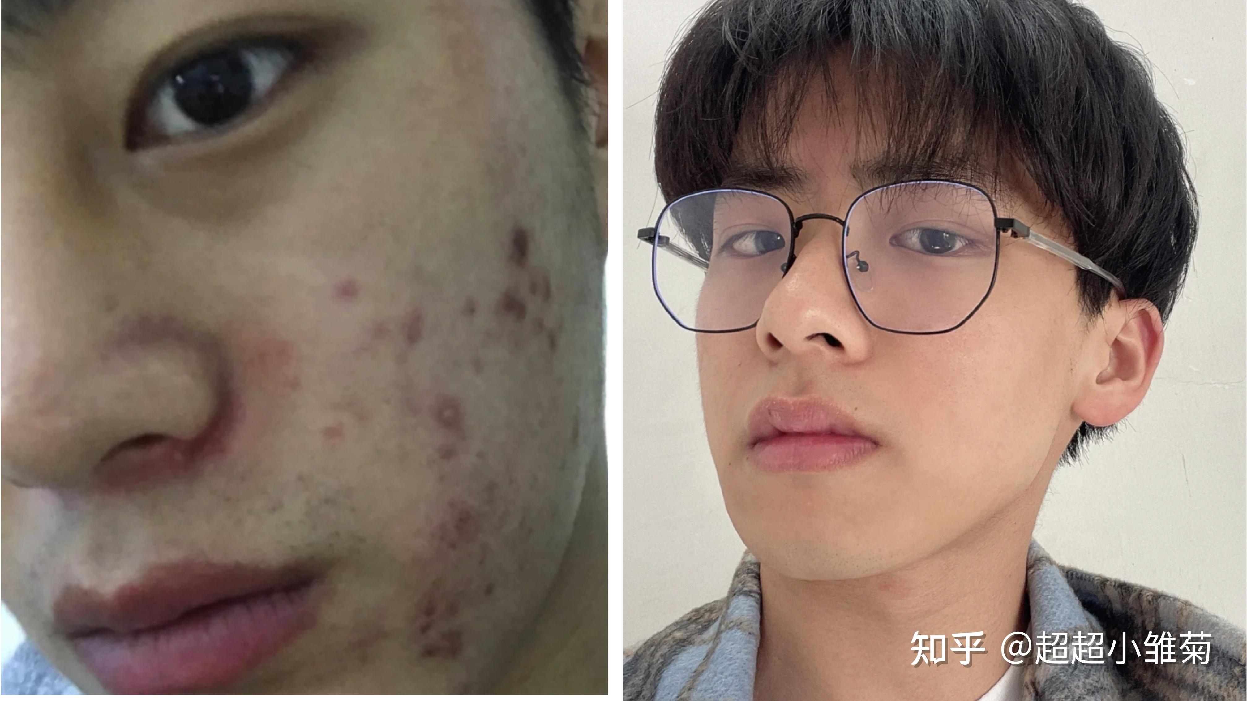 戒撸,戒烟,戒酒这些我统统都没做!