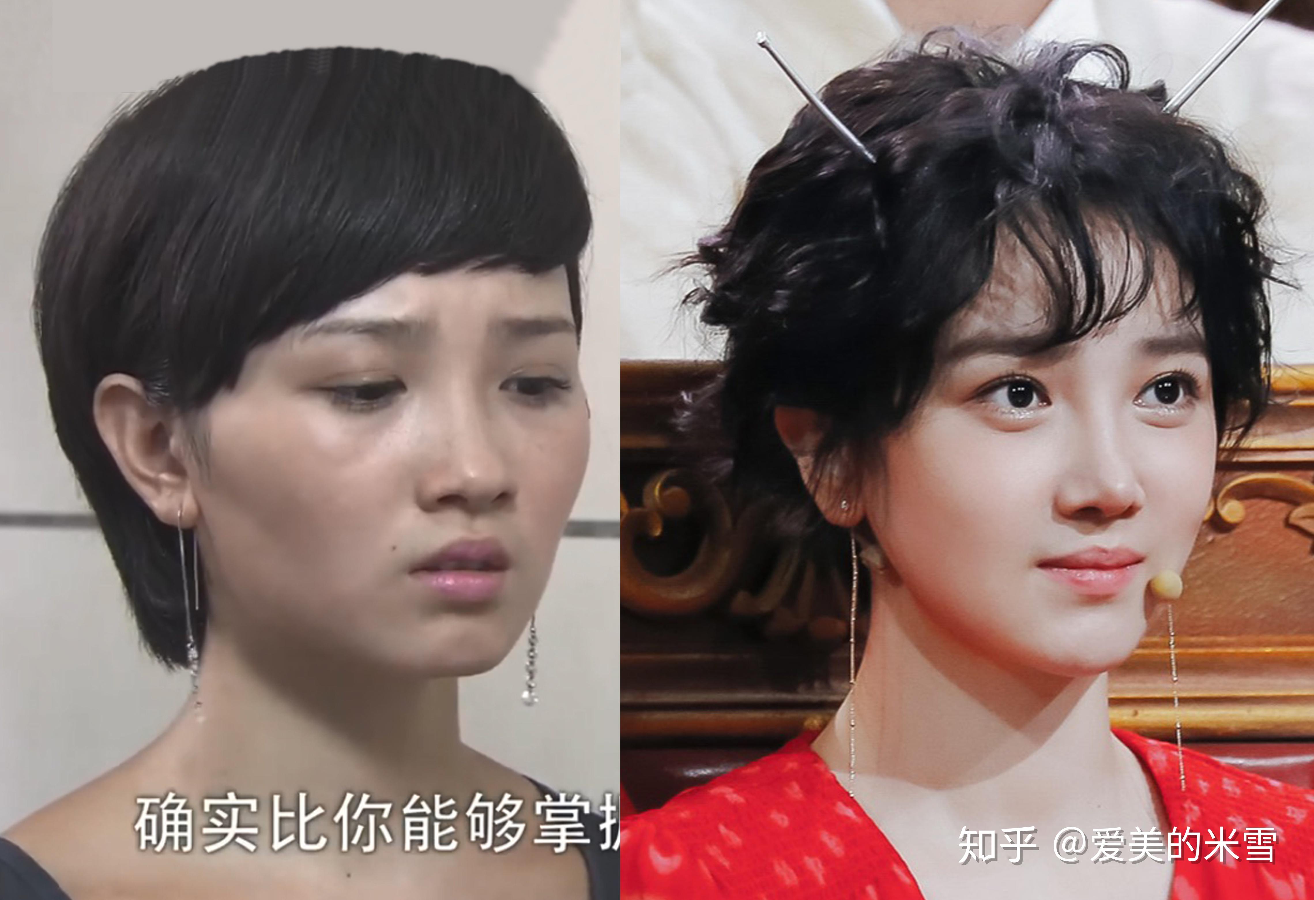 三千年美女整容前图片